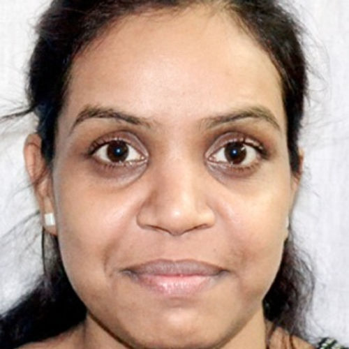 Pratima laxman Patel
